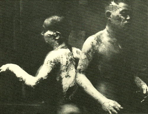 The Morning of the Holocaust:  Two Victims with Severe Body Burns